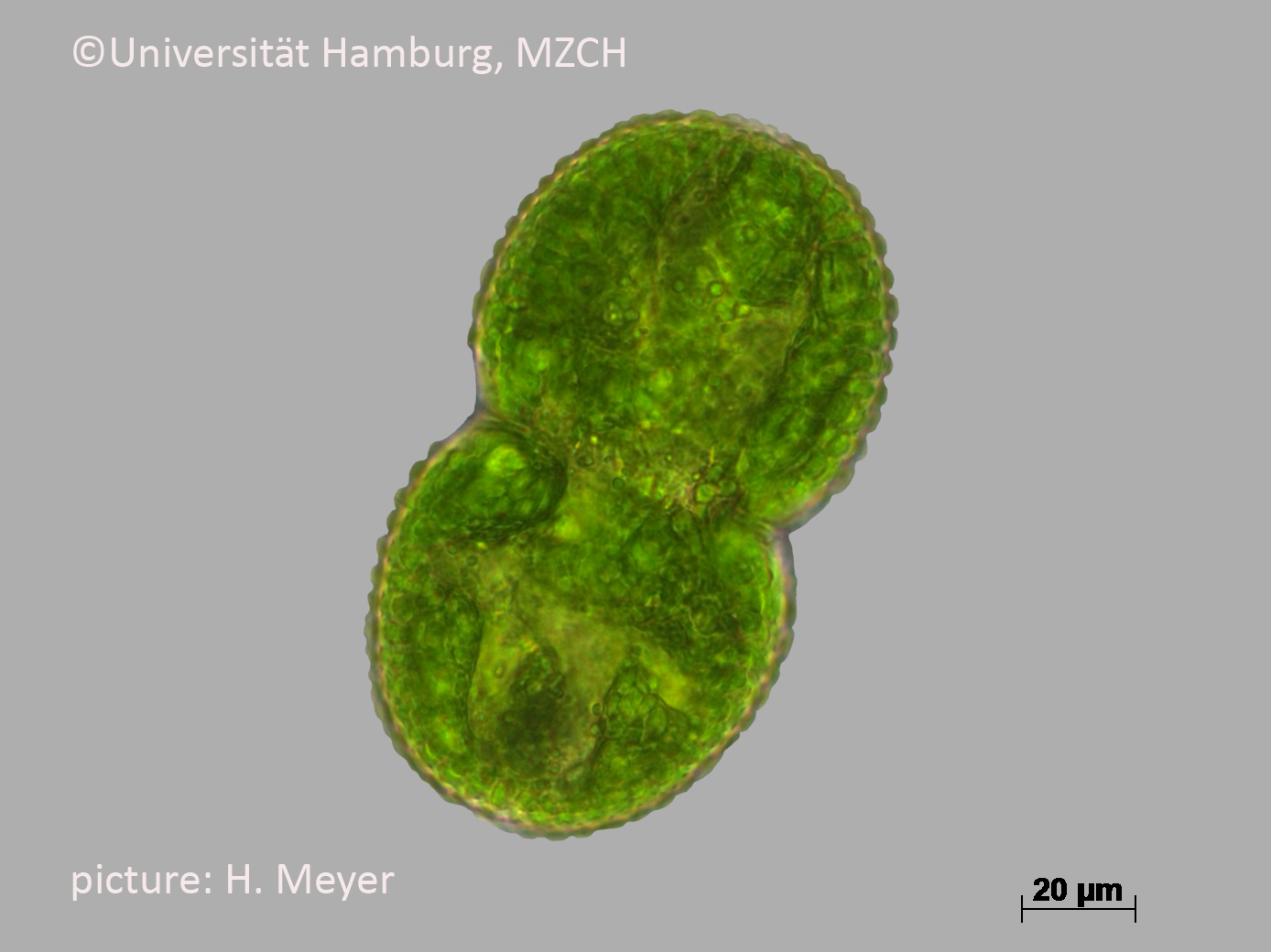 381_Cosmarium tesselatum_400x-20_H. Meyer.bmp